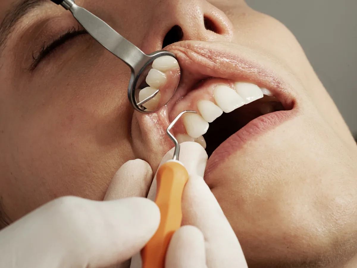 After dental treatment result
